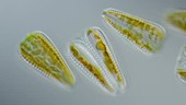 Surirella diatoms, light microscopy