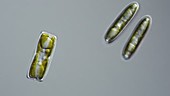 Pinnularia diatoms, light microscopy