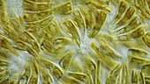 Rhoicosphenia diatoms, light microscopy