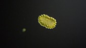 Synura algae, light microscopy