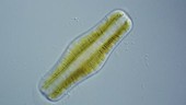 Rhopalodia diatom, light microscopy