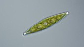 Stauroneis diatom, light microscopy