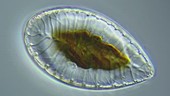 Surirella diatom, light microscopy