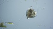 Vorticella swarmer, light microscopy