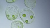 Volvox algal colonies, light microscopy