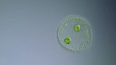 Volvox algal colony, light microscopy