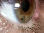 Human eye, iris and pupil