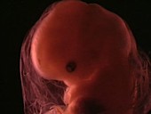 Human embryo, 8 weeks
