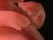 Hands of a human embryo, 8 weeks