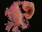 Human embryo, 5 weeks