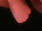Human embryo foot, 8 weeks