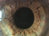 Human eye, pupil