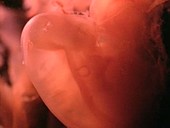 Human embryo, 3 weeks old
