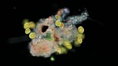 Dinoflagellates, light microscopy