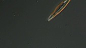 Diatom, light microscopy