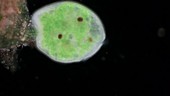 Stentor swimming, light microscopy