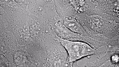 HeLa cells in culture, light microscopy