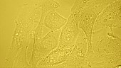 HeLa cells in culture, light microscopy