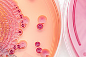 Bacterial growth on MacConkey agar