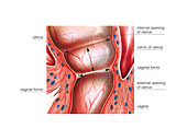 Postpartum cervix,illustration