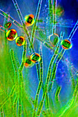 Oedogonium green algae,light micrograph