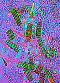 Scenedesmus green algae,light micrograph