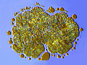 Botryococcus green algae,micrograph