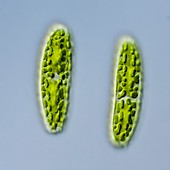 Netrium oblongum green algae,LM