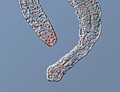 Aeolosoma Oildrop worm,LM