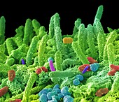 Oral bacteria,SEM