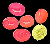 Blood cells,SEM