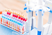 Vacutainer tubes with blood samples