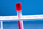 Vacutainer tube with blood sample