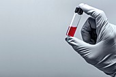 Person holding virology test tube