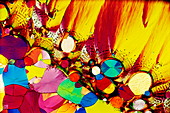 Serotonin crystals,light micrograph