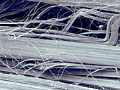 Asbestos fibres,SEM