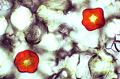 Red chromoplasts,light micrograph