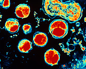 Coloured TEM of Chlamydia sp. bacteria