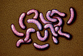 Coloured SEM of cholera-causing bacteria