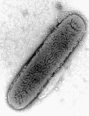 TEM of Eikenella corrodens bacteria