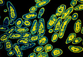 Tuberculosis bacteria,TEM