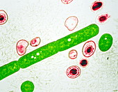 Anthrax bacteria,TEM