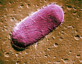 Tuberculosis bacillum