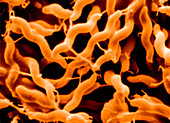 Campylobacter jejuni