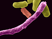 Anaerobic Pathogen