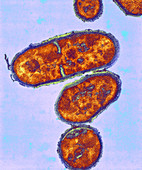 Proplonlbacterium acnes