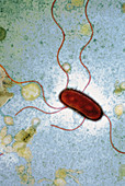 Escherichia coli bacterium