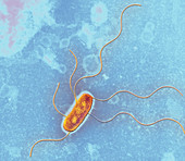 Escherichia coli Strain