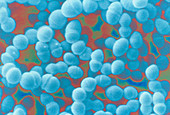 Streptococcus faecium bacteria,SEM