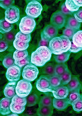 Streptococcus